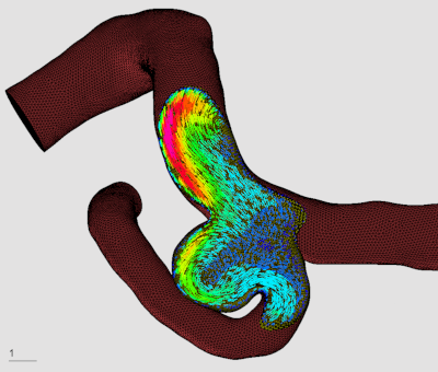 Medical CFD
